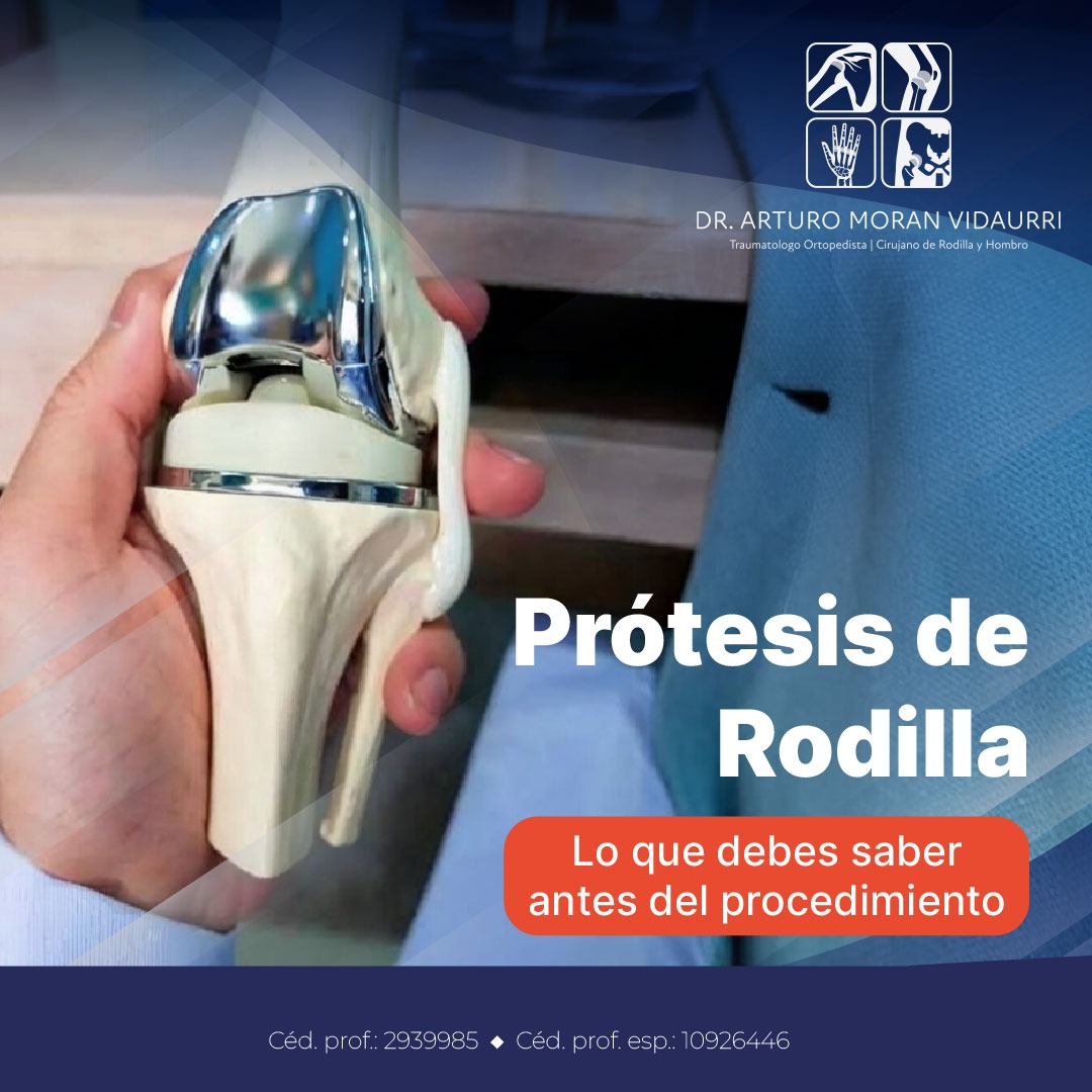 protesis de rodilla